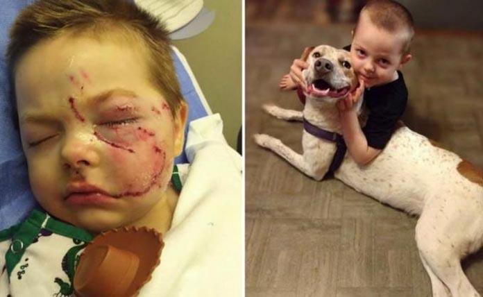 Αγοράκι παραμορφώθηκε στο πρόσωπο από επίθεση του σκύλου του